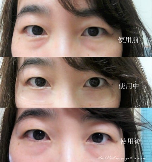 before after.jpg