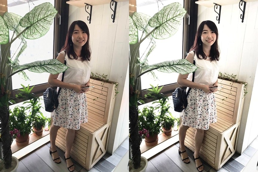 臉部線條鬆弛 圓臉.jpg