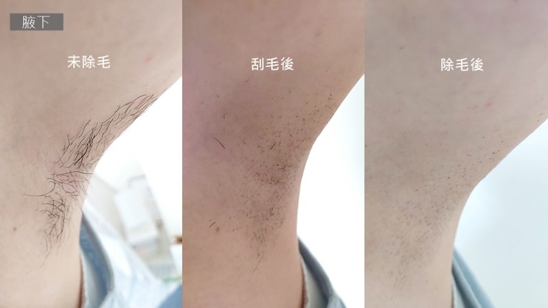 Skin Eros除毛機 腋下除毛.jpg